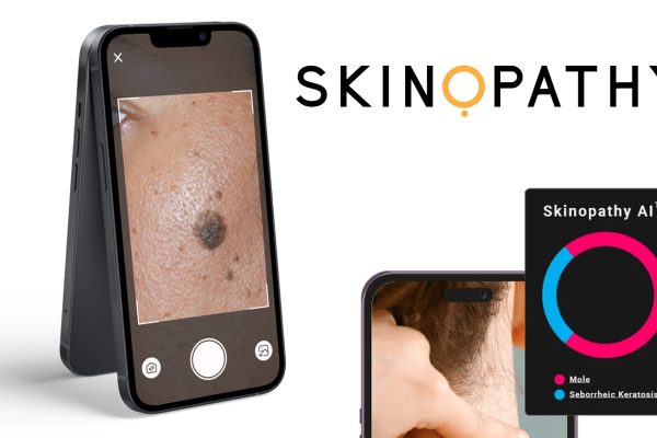 Skinopathy HealthTech App focused on Skin Cancer